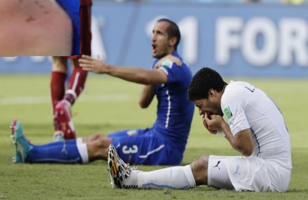 SUAREZ BITES,URUGUAY STRIKES–BREAKING NEWS: SUAREZ BANNED